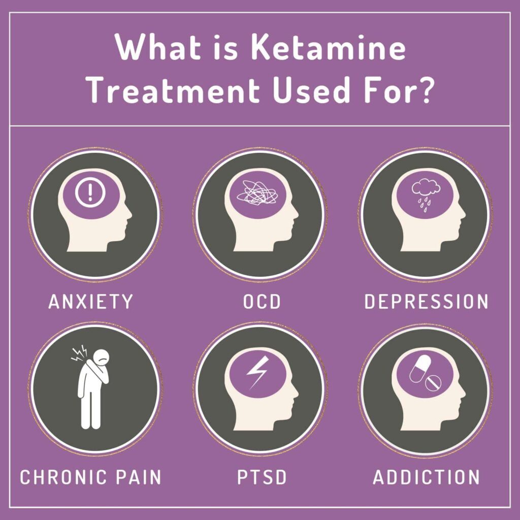 Ketamine Therapy Beaverton